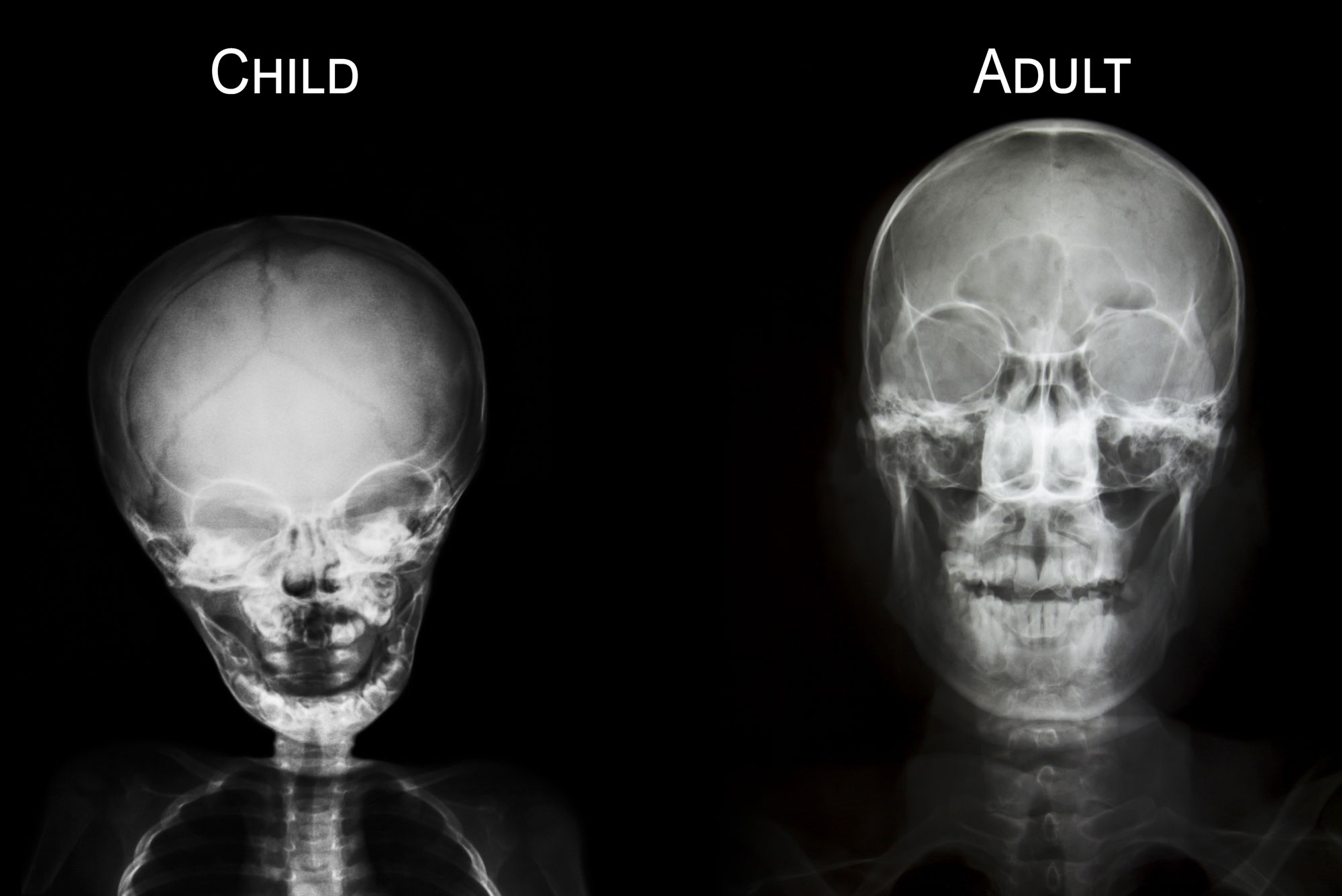 warning-parents-wireless-emf-safety-standards-abandon-children